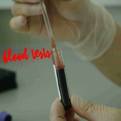 Laboratory blood test