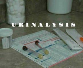 Understanding Urinalysis Tests and urine in the laboratory
