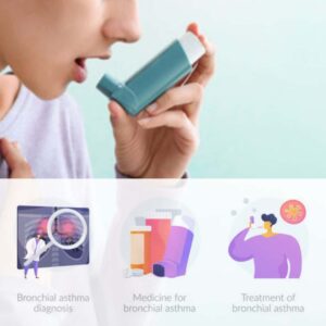 Bronchial asthma