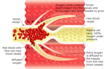 Hbot: Oxygen Treatment, How it works
