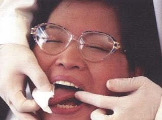 oral examination oral cancer