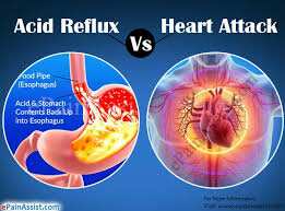 Importance Of Resolving Chronic Indigestion Issues To Avoid Acid Reflux