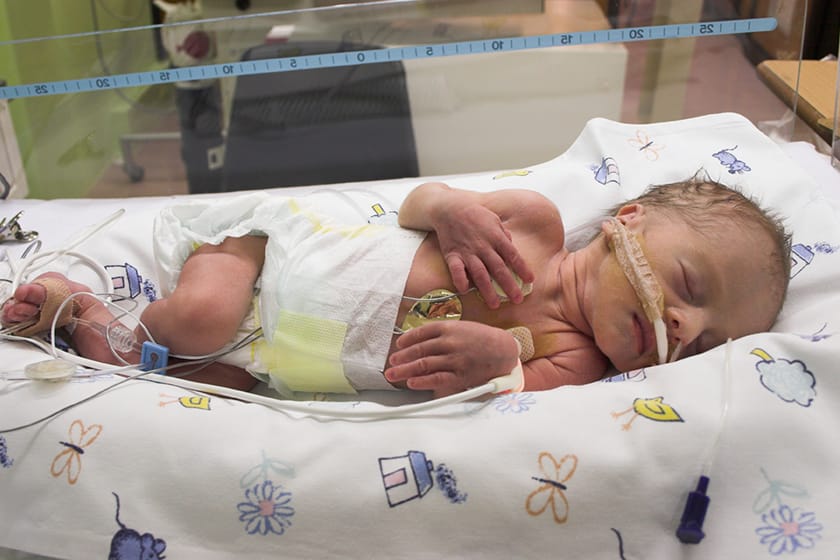 Premature birth: Complication, Diagnosis, Treatment, Prevention and Medications
