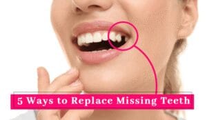 52BWays2Bto2BReplace2Ba2BMissing2BTooth