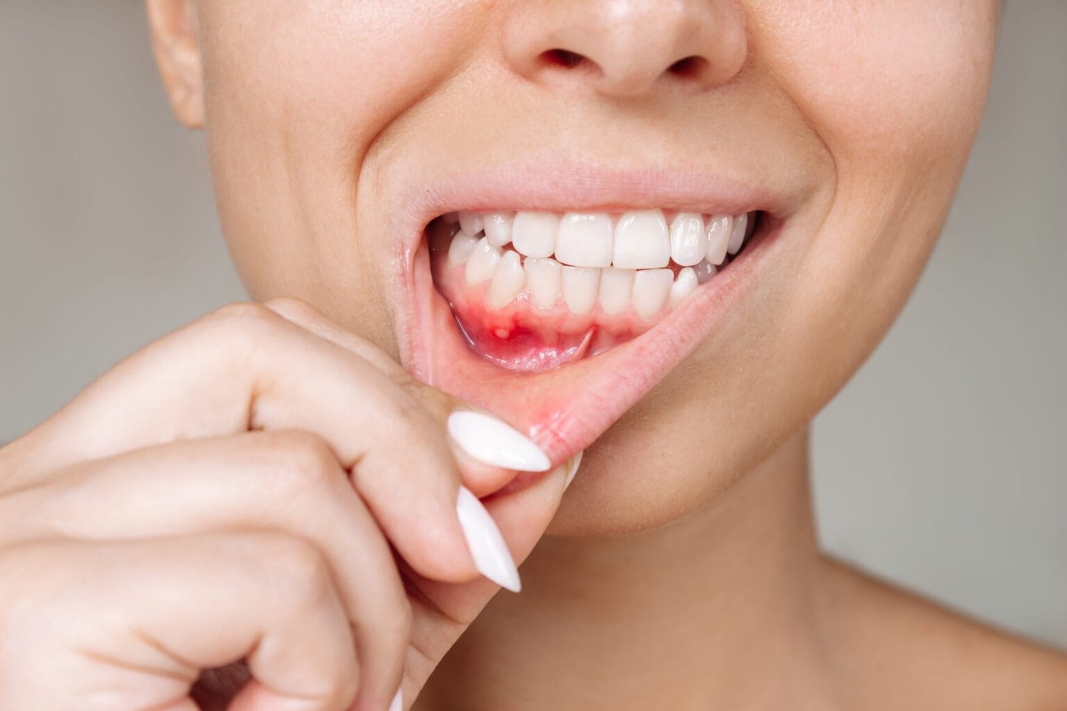11 Steps to get rid of gum disease at home? AdobeStock 565863634 scaled 1