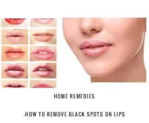 Home Remedies: How to Remove Black Spots On Lips