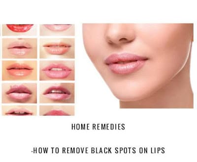 Home Remedies: How To Remove Black Spots On Lips