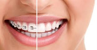 Wellington Orthodontist braces The future of cosmetic dentistry is digital