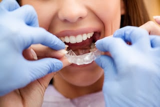 Is it worth to wear Invisalign® braces for 22 hours a day?