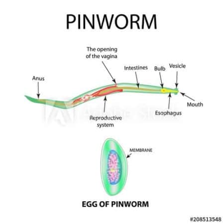 pinworm