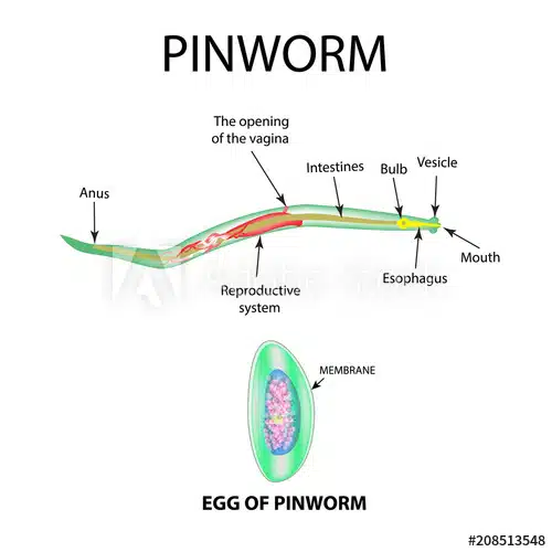 pinworm kenet enterobiasis miatt)