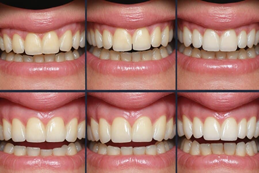 Here Are A Few Tips On The Correct Flossing Technique