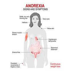 Anorexia Nervosa: Causes, Symptoms and Treatments
