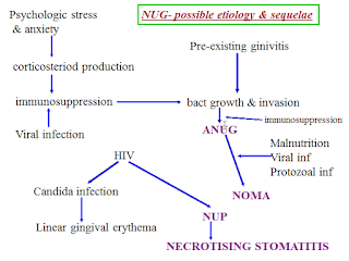 NECROTIZING ULCERATIVE GINGIVITIS