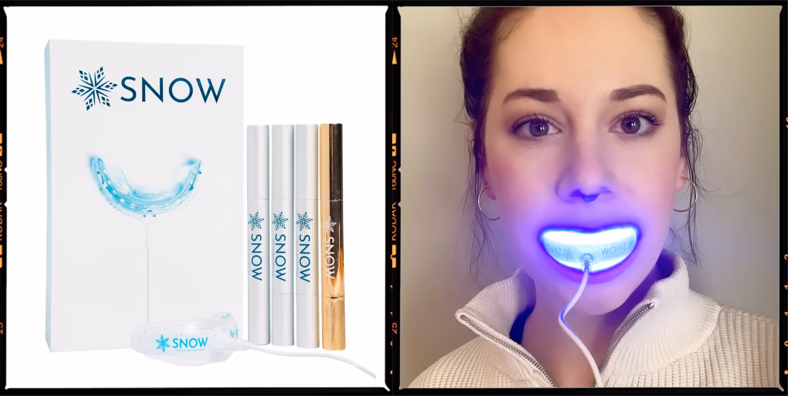 snow teeth whitening review 1649256762