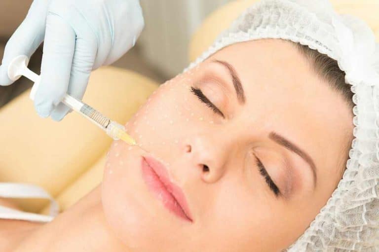 dermal fillers