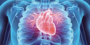 heart condition