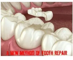 Study: Science as discovered a way to repair tooth for Future treatment.