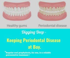 Digging Deep - Keeping Periodontal Disease at Bay
