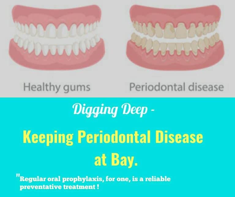 Digging Deep - Keeping Periodontal Disease at Bay