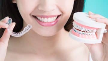 Getting Braces Soon? Here's A Guide On Different Kind Of Braces