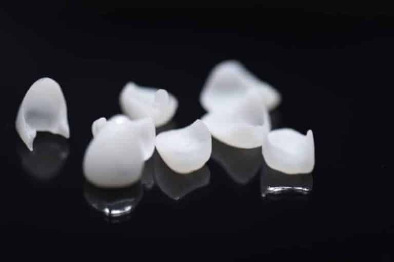 How To Take Care of Veneers and Everything Else You Need to Know