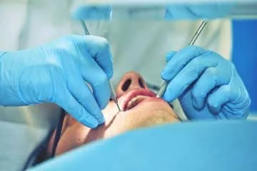 Gum disease 