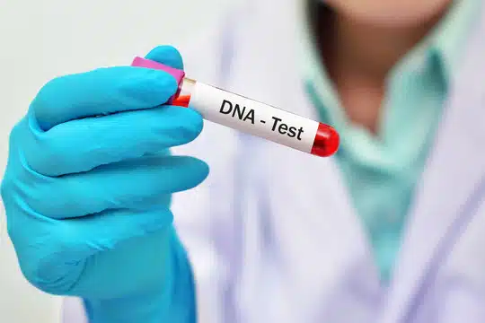 4 Things You Need To Know Before Taking a Home DNA Test