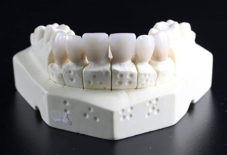 Important Things to Know About Dental Crowns