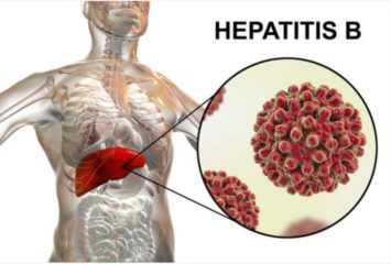 Hepatitis B Cost In Nigeria