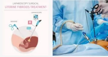 Cost of Laparoscopy in Nigeria