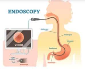 Cost of Endoscopy in Nigeria (2021): All You Need to Know