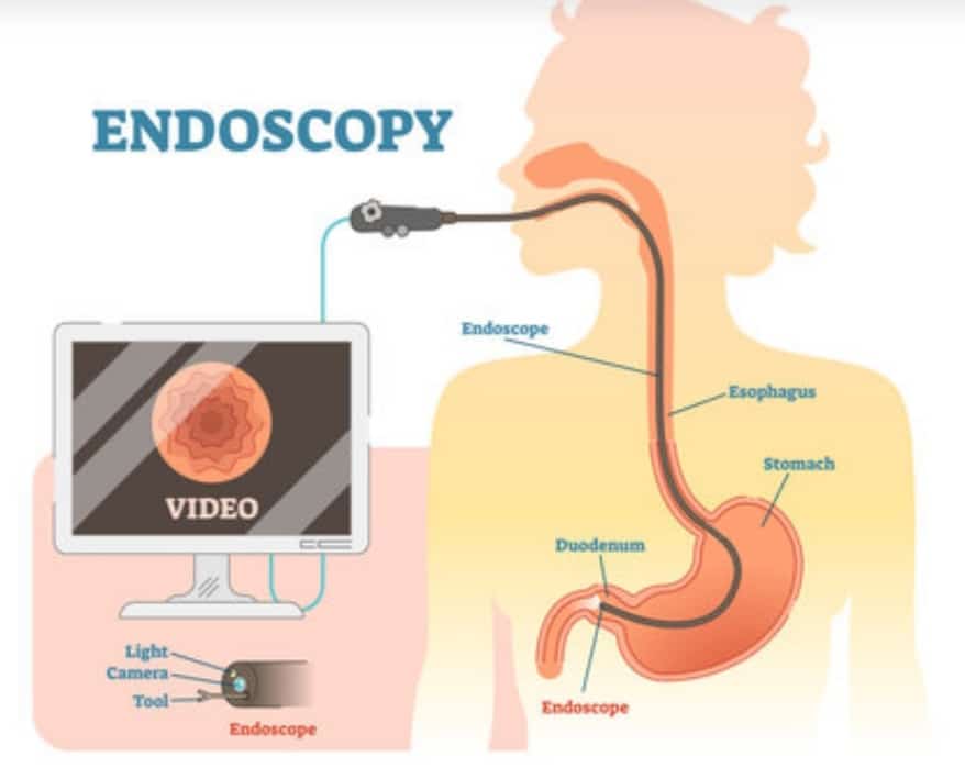 Cost of Endoscopy in Nigeria Today: All You Need to Know