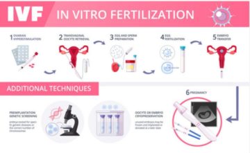 Cost of IVF in Nigeria