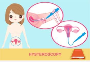 Cost Of Hysteroscopy