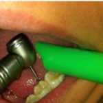 How to properly use a dental suction