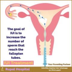 Cost Of Iui In Nigeria