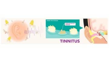 top-hearing-aids-to-use-for-tinnitus