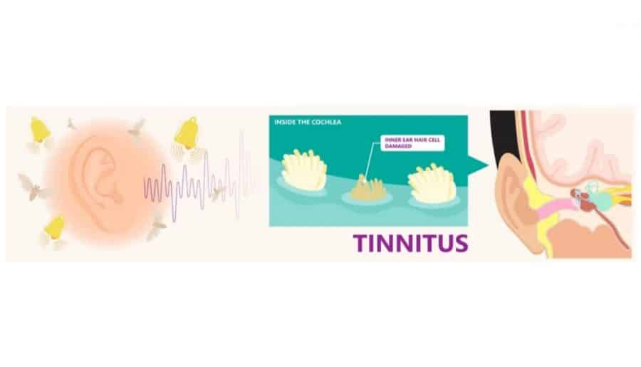 Top-Hearing-Aids-To-Use-For-Tinnitus
