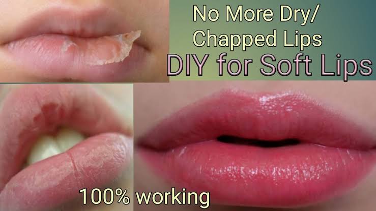10 Home remedies for chapped lips