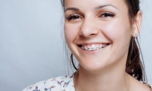 gettings-braces-second-time.jpg