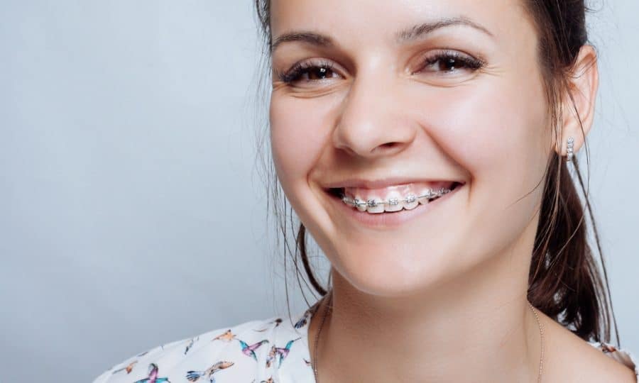 Reasons To Wear Orthodontics Braces