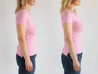 Breast lift – an alternative to breast implant