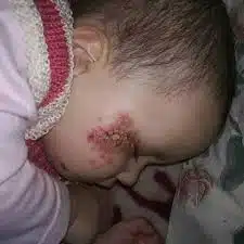 Alefo in Babies