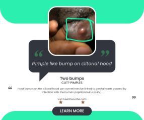 pimple like bump on clitorial hood