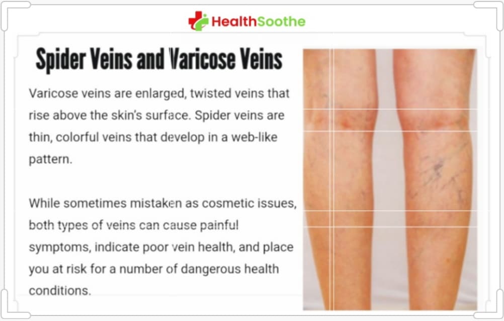 Pump Up Your Vein Health: The Role Of Nutrition
