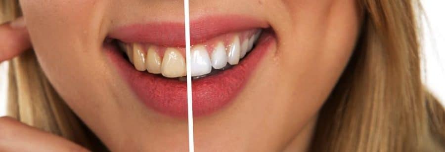 8 Oral Hygiene Tips For Healthy, White Teeth
