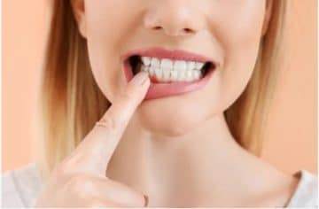 All you need to know about your gum health