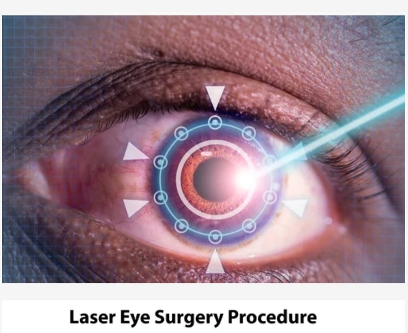 Everything You Need To Know About If Lasik Is Right For You