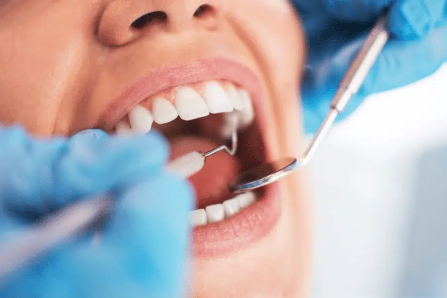 Dental Hygiene